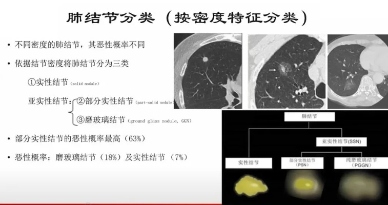 肺部小结节的成因及治疗方法介绍-第2张图片-www.211178.com_果博福布斯